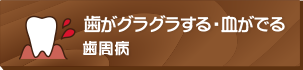 歯がグラグラする・血がでる歯周病