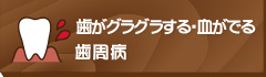 歯がグラグラする・血がでる歯周病