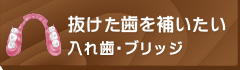 抜けた歯を補いたい入れ歯・ブリッジ